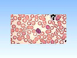 diaporama pps Nanorobots